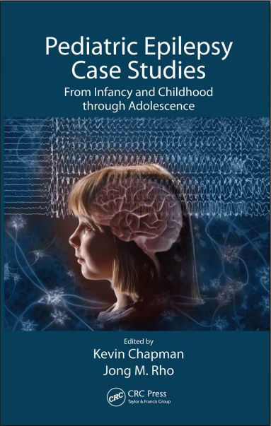 case study of a child with epilepsy