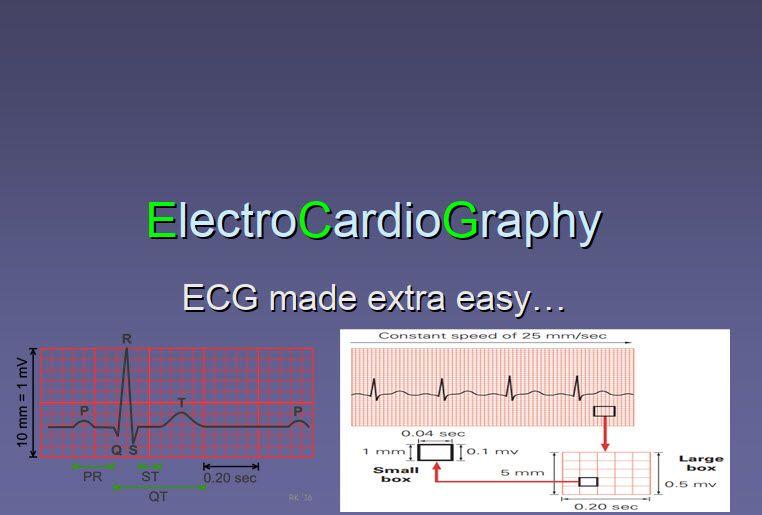 ecg made easy pdf