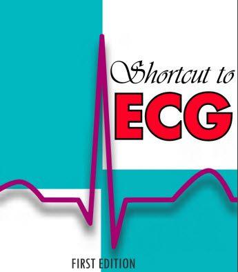 Shortcut to ECG First Edition PDF
