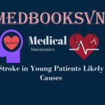 Stroke in Young Patients Likely Causes