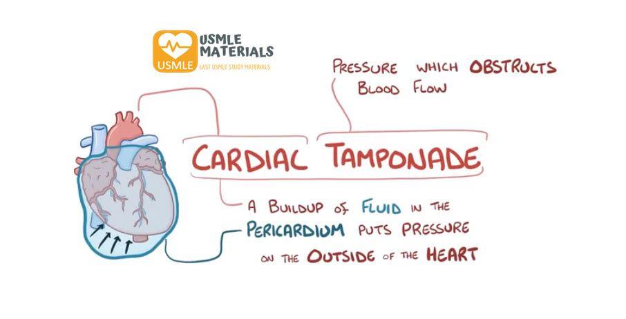 Cardiac Tamponade