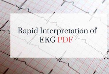 Rapid Interpretation EKG free