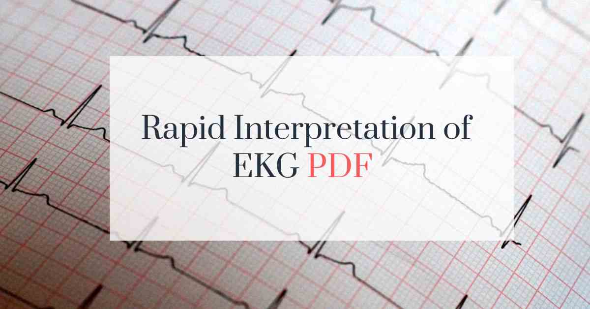 Rapid Interpretation EKG free